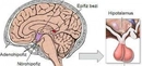 Hipofiz Bezi Yetmezliği Belirtileri ve Tedavisi Hipofiz Bezi Yetmezliği Belirtileri ve Tedavisi