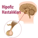 Hipofiz Bezinin Görevleri Türleri ve Özellikleri Hipofiz Bezinin Görevleri Türleri ve Özellikleri