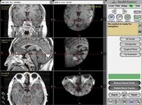 Hipofiz Mr Neden Çekilir? Hipofiz Mr Neden Çekilir?
